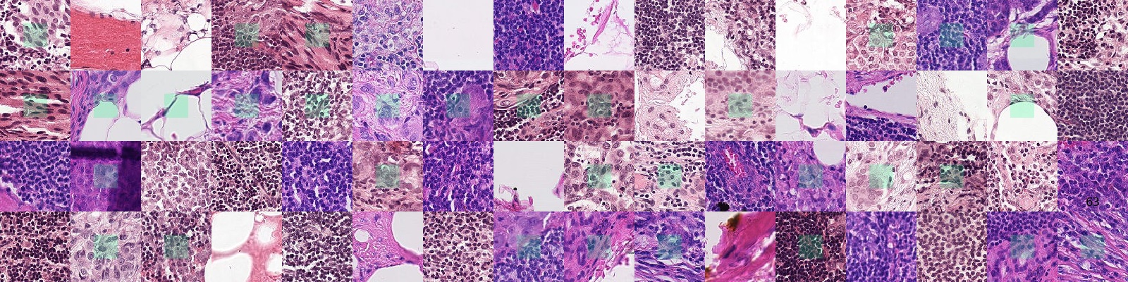 Examples from PCam. Green boxes indicate tumor tissue in center region, which dictates a positive label.